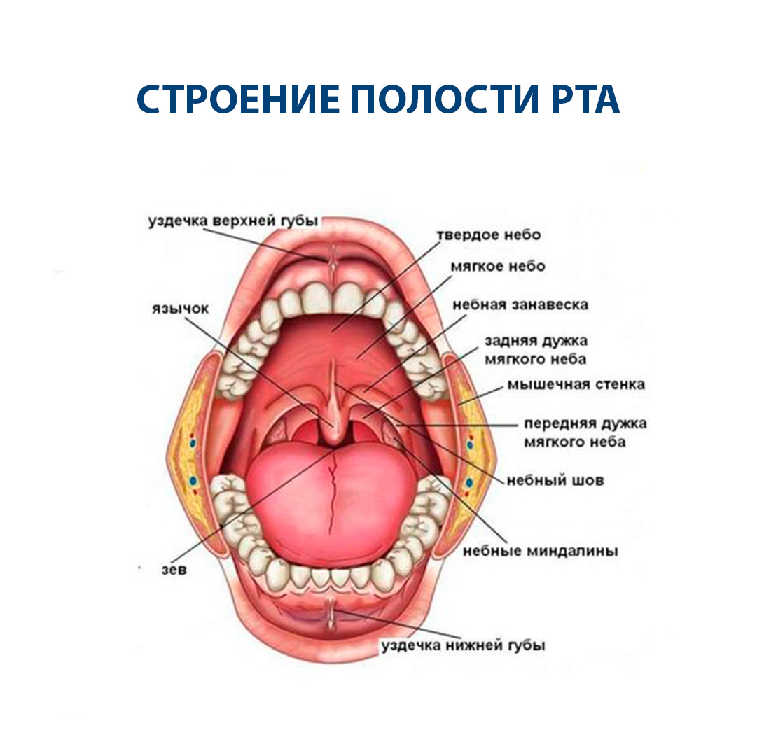 Верхняя стенка рта. Воспаление небных дужек.